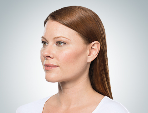 kybella lady 1