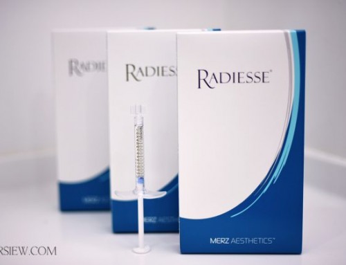 Radiesse injections are available at Raleigh Plastic Surgery from Kaitlyn Gozzo, our nurse injector! This month, we are offering specials on all of our injectables, including Radiesse!  Call us today to schedule an appointment! +1 919-872-2616 https://raleighplasticsurgery.com/staging/