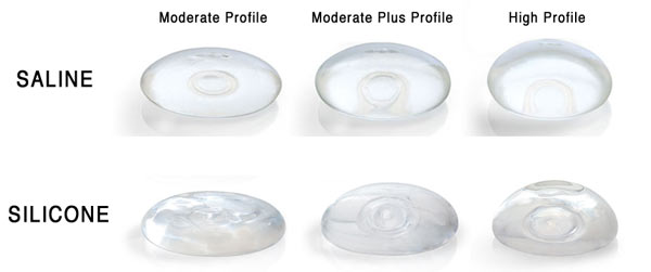 Saline Gel Breast Implants vs Silicone Breast Implants, Which is