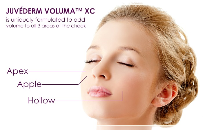 juvederm_voluma_xc_banner