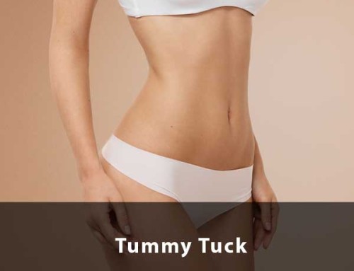 What is a mini tummy tuck and why can’t I just get one of those?