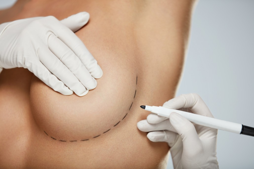 Breast Reduction in Raleigh