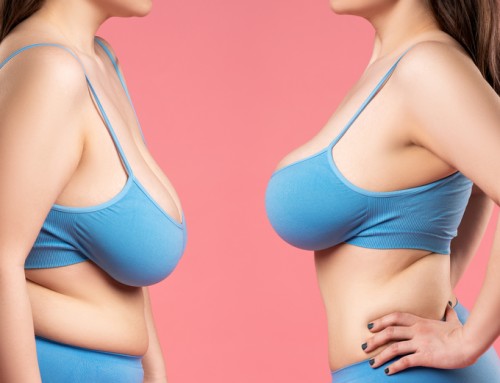 Are breast lifts or augmentation better for results?  Or both?