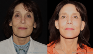 Carrie Peele 1 (1)logo