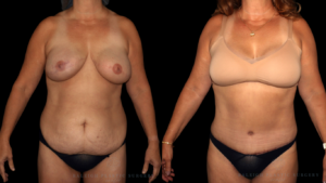 Patient D front logo