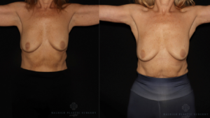 Patient E front logo