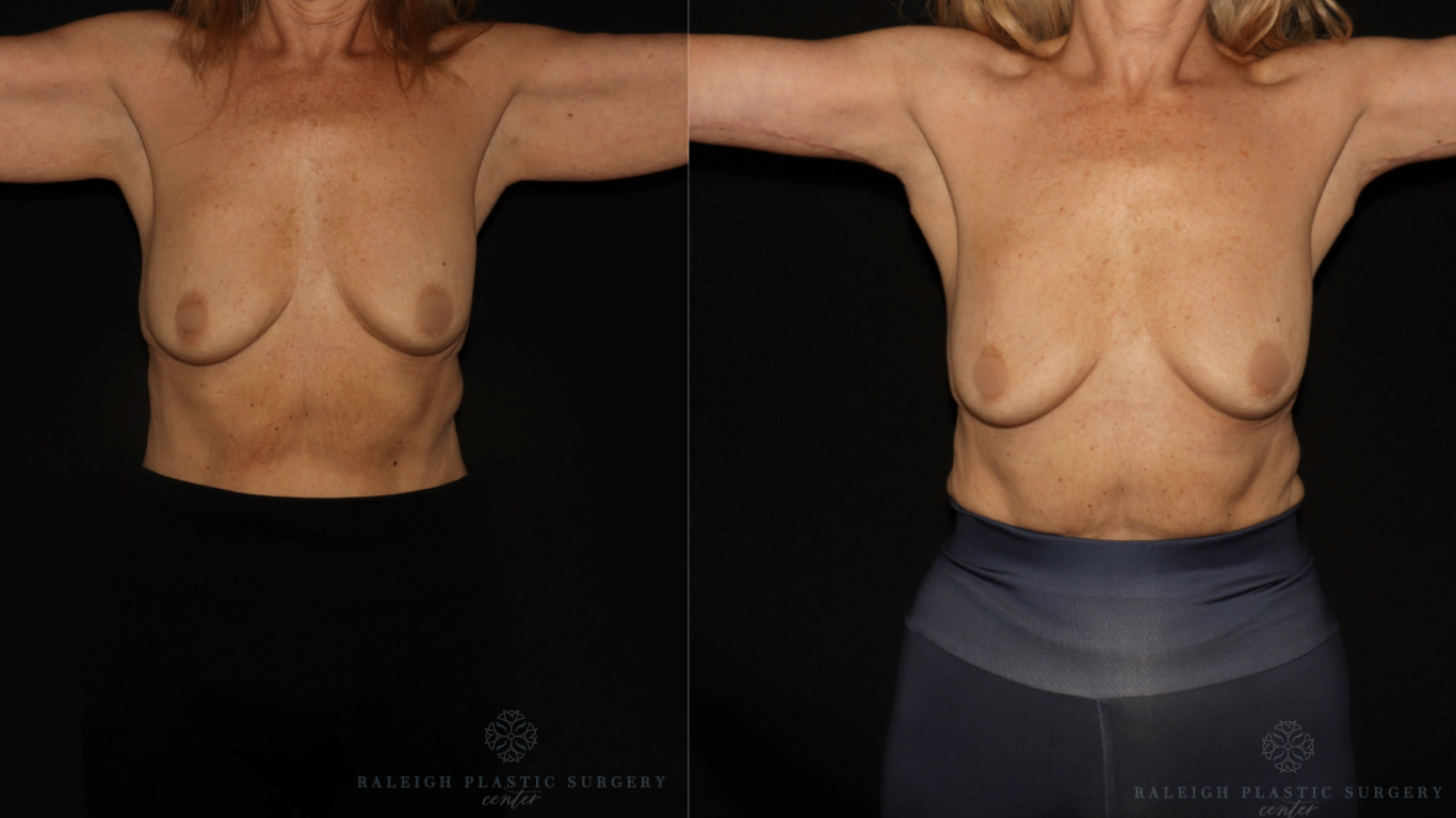 Patient E front logo